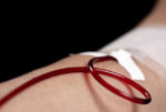 رفع تعرفة تنقية الدم من الكوليسترول‏ إلى 76 مليوناً image