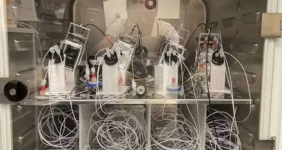 علماء يصنعون حاسوباً خارقاً من خلايا دماغ بشري image