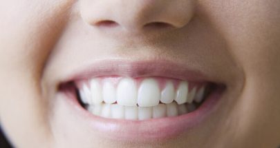 إكتشاف إرتباط بين فقدان الأسنان وزيادة خطر السمنة image